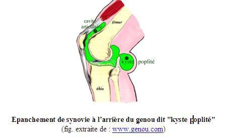 Massage epanchement synovie