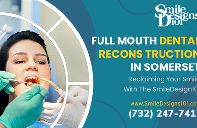 The Benefits of Full Mouth Dental Reconstruction with SmileDesigns101 in Somerset