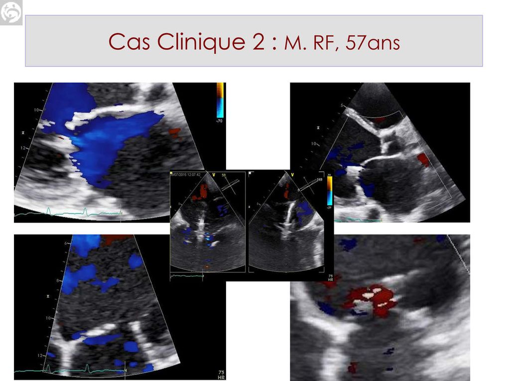 CAS CLINIQUES