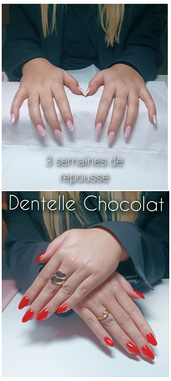 Onglerie Antibes. Dentelle Chocolat vous propose du Nail-art Baby boomer . Manucure et beauté des pieds