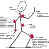 Boutons les troubles musculo-squelettiques hors de nos bureaux !