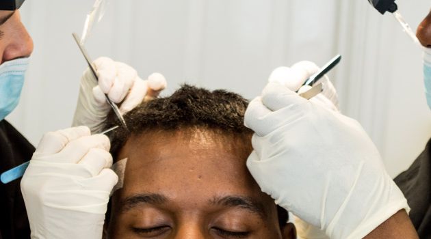 6 reasons why hair transplant is a great option