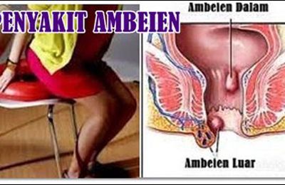 Tanaman Obat Herbal Ambeien