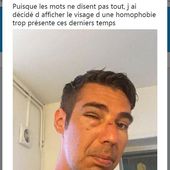 Gironde : un trentenaire porte plainte pour agression à caractère homophobe après avoir été frappé et insulté à Bordeaux