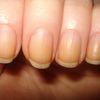 Quick-Tipps #1: Was hilft gegen verfärbte Fingernägel?