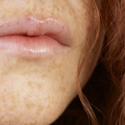 Les « fausses » tâches de rousseur, la tendance du moment