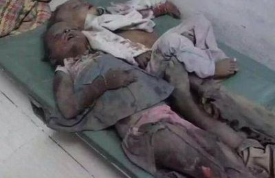Yémen : Silence on massacre … Avons-nous perdu notre humanité ? 