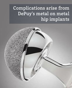 Hip Implant Issues Talked About by Specialists