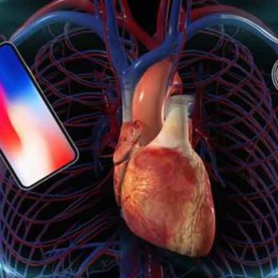 Apple prévient que l’iPhone peut « interférer » avec les dispositifs cardiaques