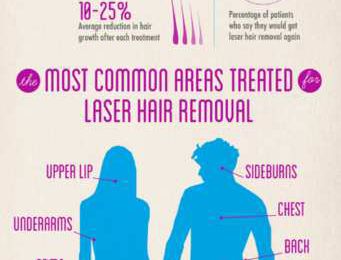 Growing Popularity of Laser Hair Removal