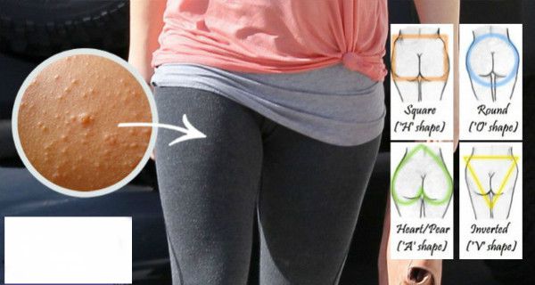 Vous devez lire si vous avez porté Pantalon de yoga Avant!