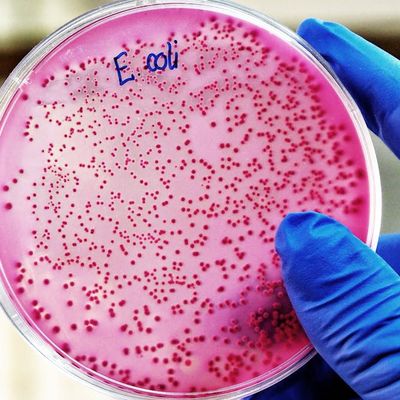 Aliments contaminés par la bactérie ? E. coli ? : quels effets sur la santé et comment prévenir les infections ? 
