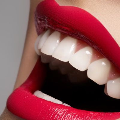 Comment avoir les dents plus blanches?