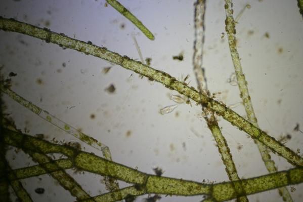 Photos diverses prises au microscope