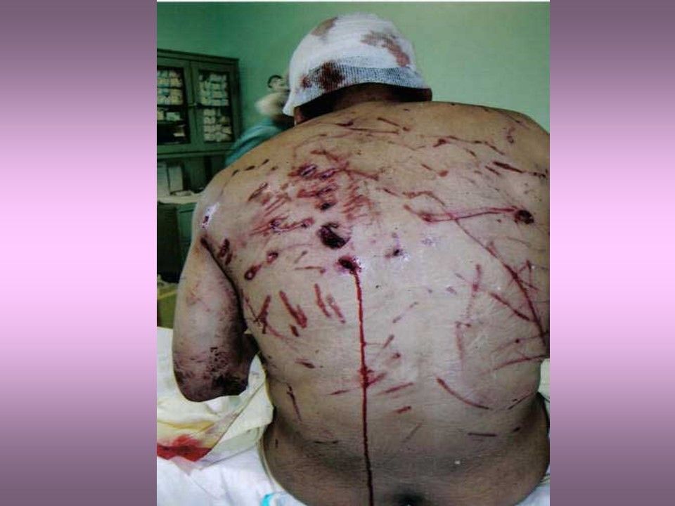 Divers - Cache-Cache