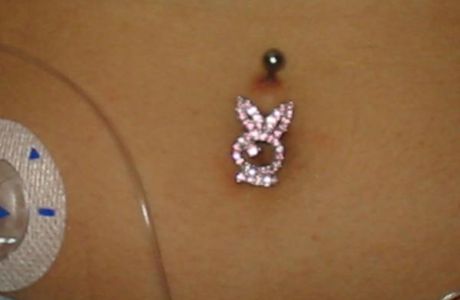 PIERCING ET DIABETE