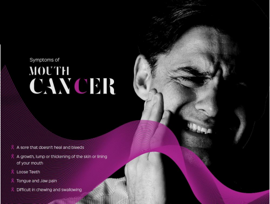 Everything to Know About Oral Cancer