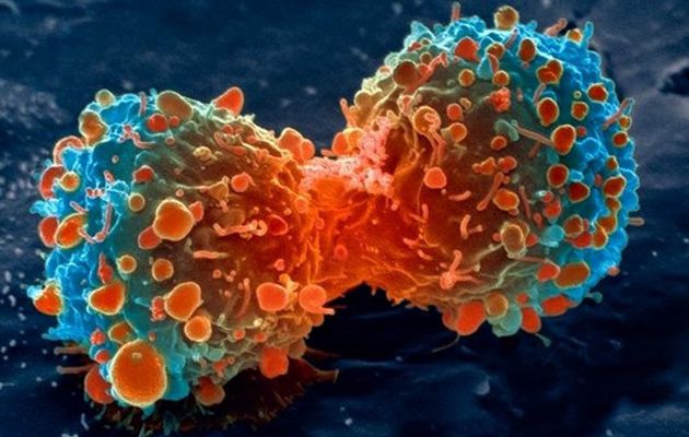 Un virus qui s’attaque au cancer du cerveau et stimule notre système immunitaire