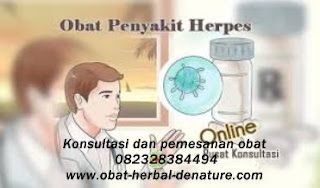 Cara Pengobatan Penyakit Herpes Secara Herbal