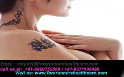 Breast cancer treatment and surgery in India at an affordable money budget