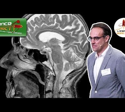 Science En Direct - L'IRM à la loupe | Alexandre Vignaud