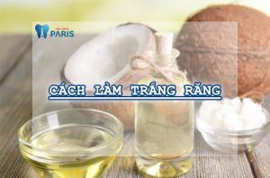 Top 3 cách tẩy trắng răng tại nhà siêu dễ