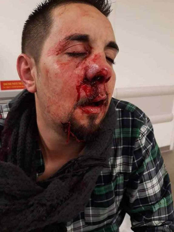 Gilets jaunes - Quand la sauvagerie bestiale des serpents au pouvoir fait force de loi sous le Macrotal !!!!