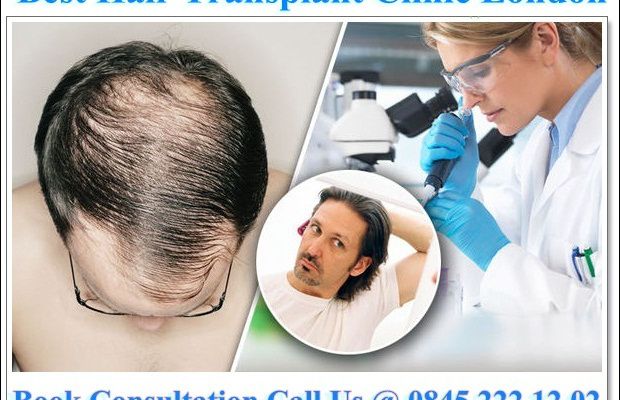 Get Best Hair Transplants and Hair Loss Treatment in UK -rejuvenate hair clinics