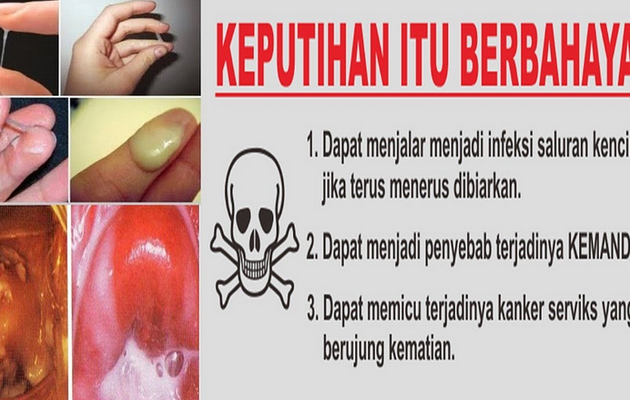 Obat Keputihan Akut Paling Ampuh