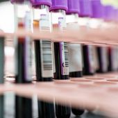 Tiny Blood Clots May Be to Blame for Long COVID Symptoms, Some Researchers Say
