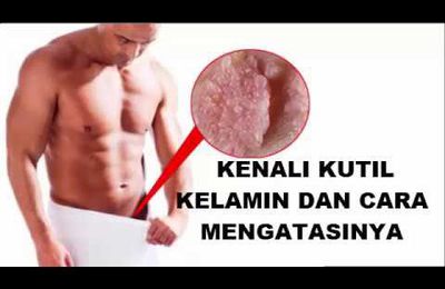 Obat Penambah Stamina Pria / Obat Kuat Permanen De Nature di Kab. Bulungan Kalimantan Utara