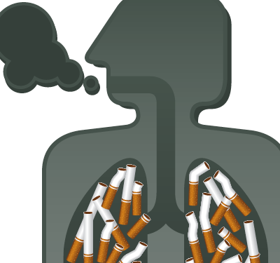 La maladie pulmonaire obstructive chronique plus meurtrière que le cancer du poumon