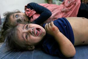  A wounded Palestinian girl, reported to have been injured in an Israeli shelling in Rafah