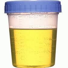 Boire son urine pour se soigner ? 