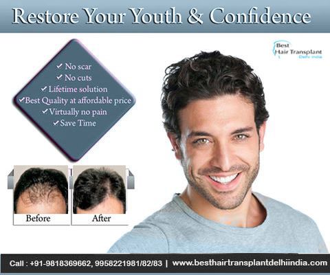 Hair Restoration Post-Surgery Instructions - Best Hair Transplant Delhi India