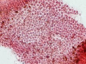 Coupe des lames du Coprin disséminé pour l'étude de la structure au microscope (Massembre Novembre 2019)