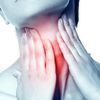 Nguyên nhân, triệu chứng và cách chữa viêm họng hạt dứt điểm