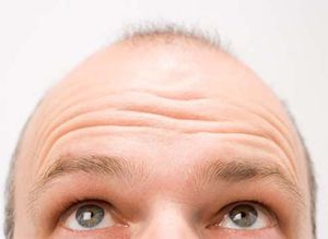   3 THINGS YOU MUST KNOW ABOUT HAIR TRANSPLANT