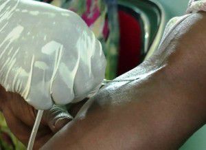 Sang contaminé au VIH/SIDA au Cameroun : la transfusion sanguine reste dangereuse