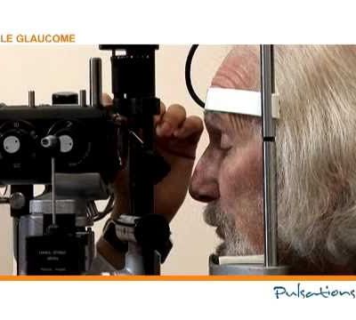 Le terme de glaucome désigne tout un groupe de maladie oculaire associées à une pression intraoculaire trop élevée