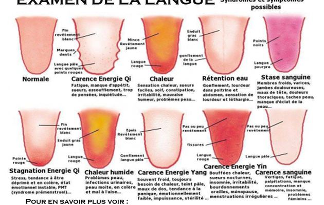 Comment maigrir de la langue