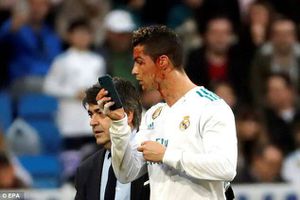 Ronaldo demonstrates as the vainest footballer