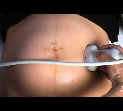 Alors la VME c'était comment ?