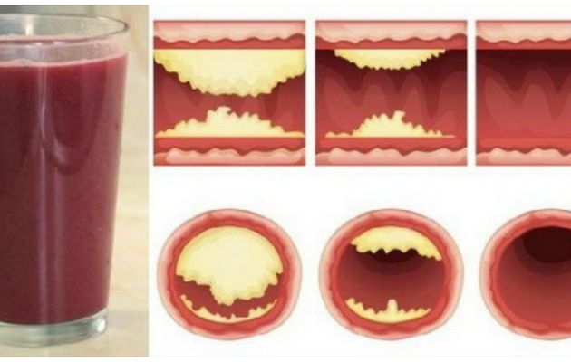 10 ALIMENTS QUI DÉLIMITENT LES ARTÈRES NATURELLEMENT ET PROTÈGENT CONTRE L'ATTAQUE CARDIAQUE