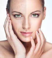 Skin Rejuvenation in Adelaide for the Best Results