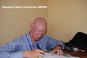 Albinos au Sénégal: Une école pour tous avec l'ANPRAS