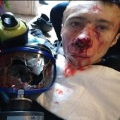 Pour l'anniversaire des Gilets Jaunes, un journaliste reçoit une grenade en plein visage - MOINS de BIENS PLUS de LIENS
