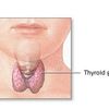 Les hyperthyroïdies, mise au point rapide.