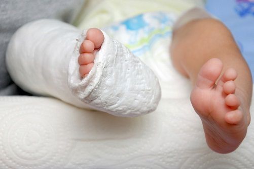 Birth Injury Lawyer Compensate for the Loss