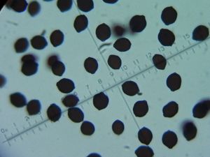 Coprin blanc de neige : spores lenticulaires 16 X 12 X 8 µm- Basides bisporiques